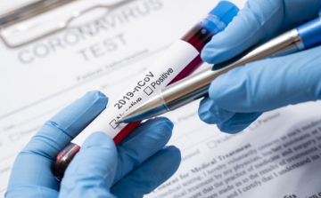 A Dombóvári Támasz Otthon gondozottjain és dolgozóin is végeztek koronavírus tesztet