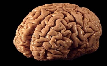 Bőrsejtekből fejlesztettek emberi agymodellt