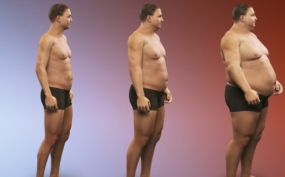 Tízféle rosszindulatú daganatféleség kockázatát növeli a túlsúly és az elhízás