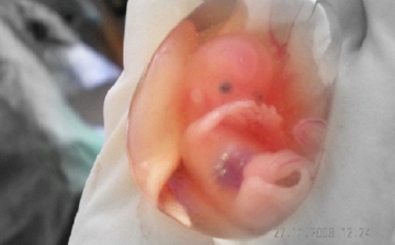 Leerőszakolta terhes barátnője torkán az abortusztablettát